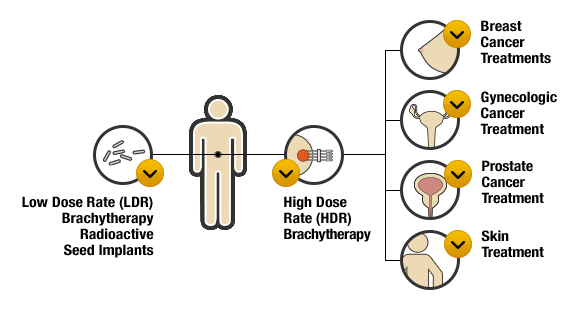 systemic radiation therapy