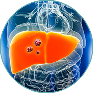 Liver Cancer